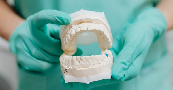 5 Reasons to Consider Dentures