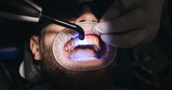 7 Tips for Whiter and Brighter Teeth 7 Tips for Whiter and Brighter Teeth