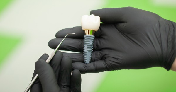 Dental Implants in Garland: Tips for Before and After Care