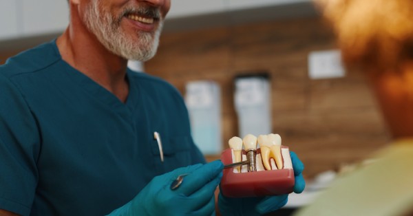 Dental Implants in Garland: Your Complete Smile Guide