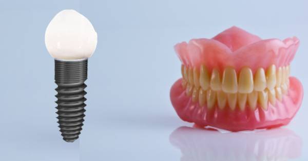 Dental Implants vs. Dentures: Making the Right Choice in Garland