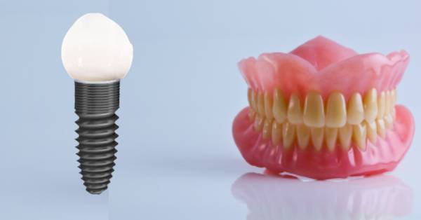 Dental Implants vs. Dentures: Making the Right Choice in Garland Dental Implants vs. Dentures: Making the Right Choice in Garland