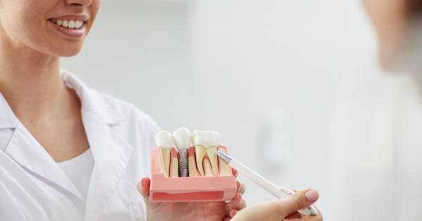 Essential Tips for Caring for Your Dental Implants in Garland