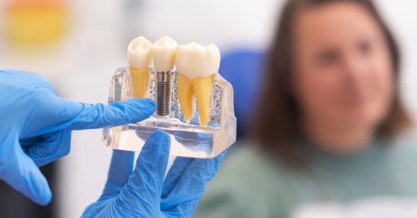 How to Avoid Common Dental Implant Problems in Garland How to Avoid Common Dental Implant Problems in Garland