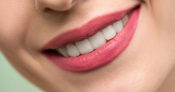 The After-Effects of Teeth Whitening