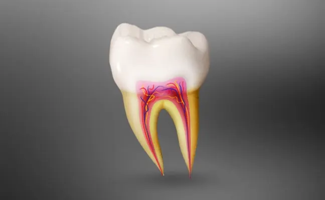 Root Canal Garland Root Canal Garland
